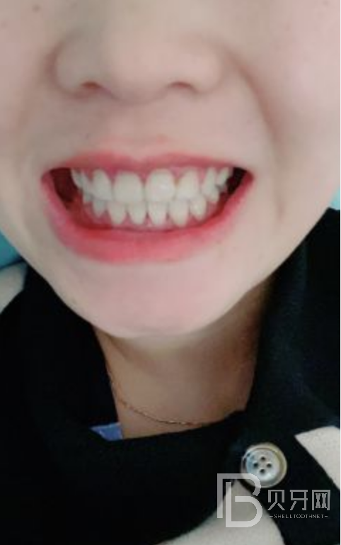 網(wǎng)友親身經(jīng)歷，齒康口腔做牙齒矯正怎么樣？靠譜嘛？