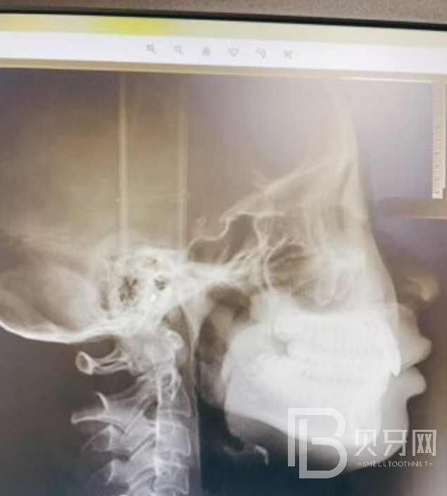 深圳瑞爾齒科做牙齒矯正靠譜嗎？