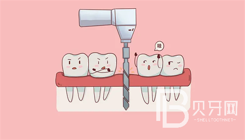 盤點上?？谇慌琶笆t(yī)院！治牙齒找放心醫(yī)院！