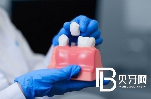 上海雅悅口腔怎么樣，聽說做種植牙醫(yī)生技術(shù)不錯？