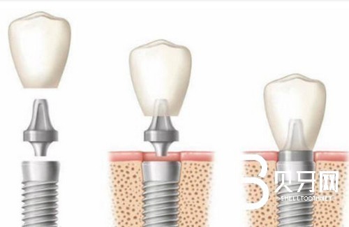 上海卓爾口腔怎么樣？簡介/地址/價格表這都有！