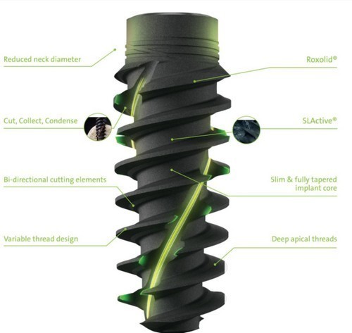 深圳德貝美口腔怎么樣？種植牙價格及地址公布！