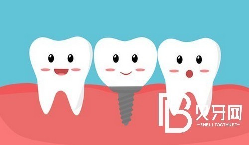 上海黃浦區(qū)種植牙價格表，種牙好又便宜的牙科