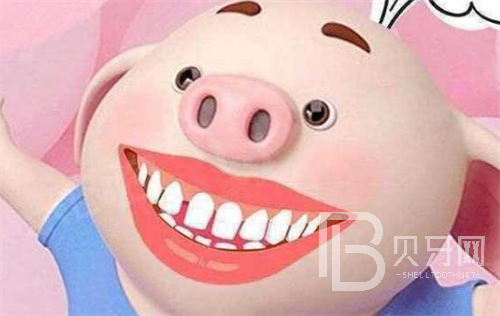 2022新版上海牙齒矯正價(jià)格表，上海哪家醫(yī)院牙齒矯正好？