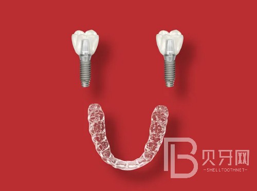 上海成人牙齒矯正大概價格多少錢，費用價格都是怎么算的