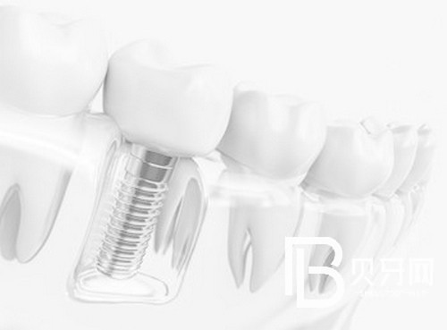 盤點北京牙齒矯正好口碑醫(yī)院，這幾家值得一去！