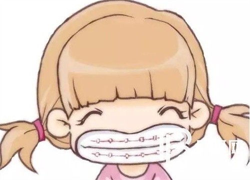 上海鑫齒口腔牙齒矯正好嗎？時(shí)代天使和隱適美有效果差別嗎？