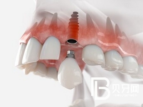 北京京一口腔怎么樣？醫(yī)院簡介優(yōu)勢項目統(tǒng)統(tǒng)都有！