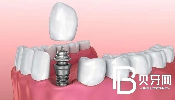 蘇州美奧口腔怎么樣？看牙貴不貴？