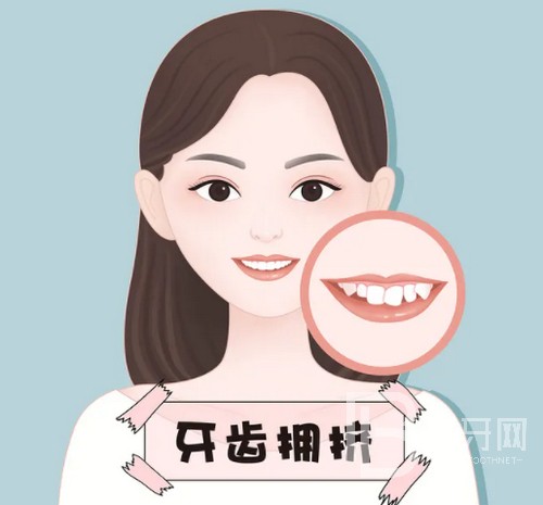 北京牙齒矯正大概要花費(fèi)多少錢？公布2022年北京牙齒矯正價(jià)目表