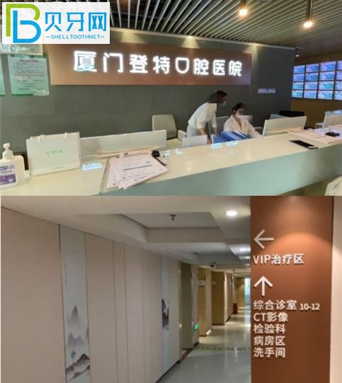 登特牙齒不到半個小時就搞定了，你知道嗎？