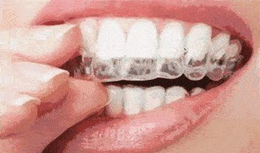 北京中諾口腔醫(yī)院種植牙技術好的醫(yī)院，好口碑不是空穴來風