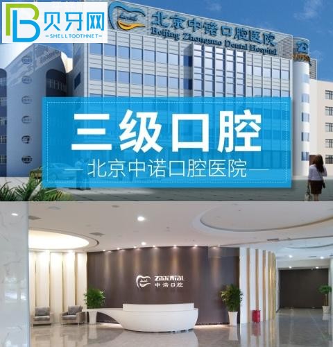北京中諾口腔真實評價