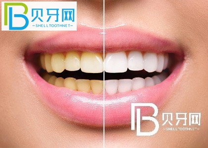 上海瑞爾齒科怎么樣？口碑如何？附上海各門店地址