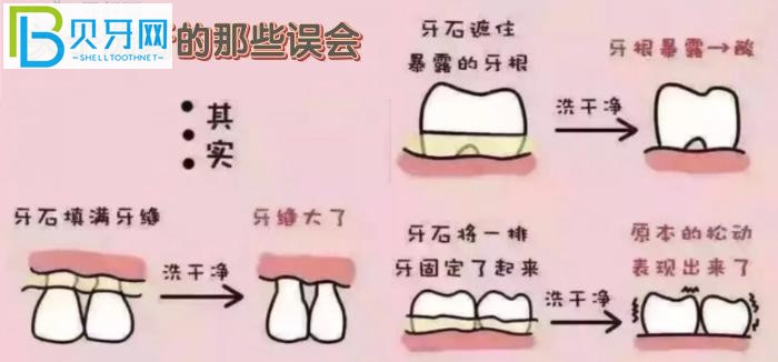 萬州牙科醫(yī)院哪里好？推薦品善和牙博士兩家口碑好的牙科診所給你！