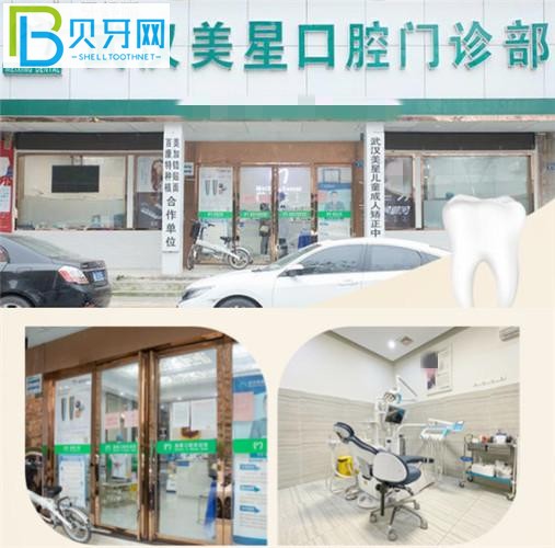 武漢美星口腔收費價格表貴嗎