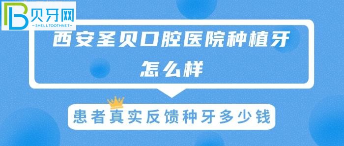 西安圣貝種植牙怎么樣，患者真實反饋種牙多少錢？(圖)