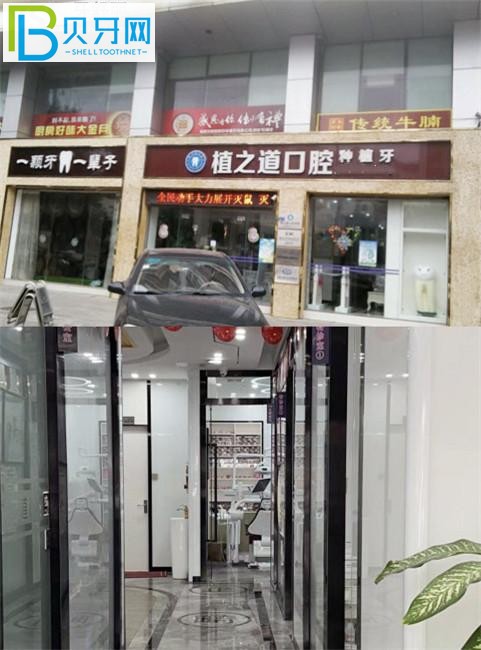 ?？谥仓揽谇环N牙怎么樣