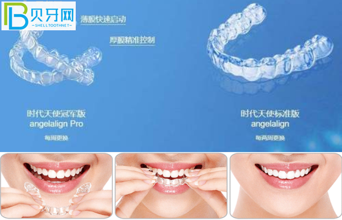 珠海隱形牙套哪家醫(yī)院比較好?推薦暨博口腔技術好價不高!