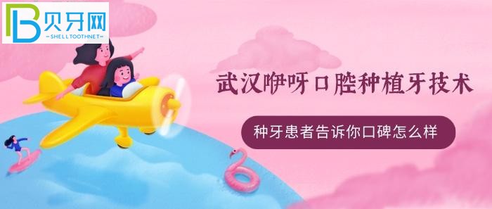 All-on-4/6種植牙技術(shù)好不好？(組圖)