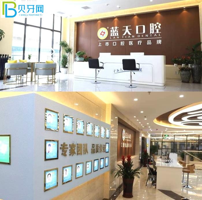 玉林口腔醫(yī)院哪個(gè)好?當(dāng)?shù)卦u(píng)價(jià)藍(lán)天口腔醫(yī)院正規(guī)靠譜技術(shù)好