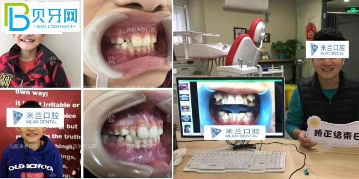 沈陽米蘭口腔門診部口碑好不好