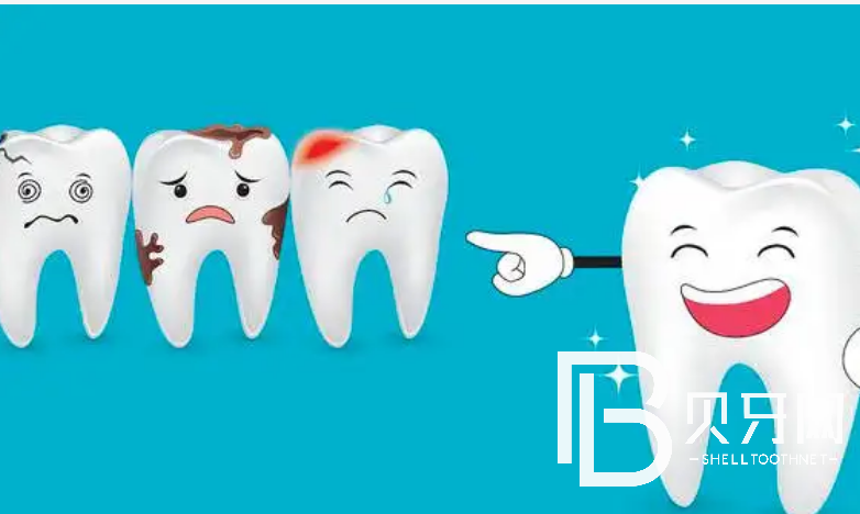 廣州瑞爾齒科怎么樣？看牙貴不貴？