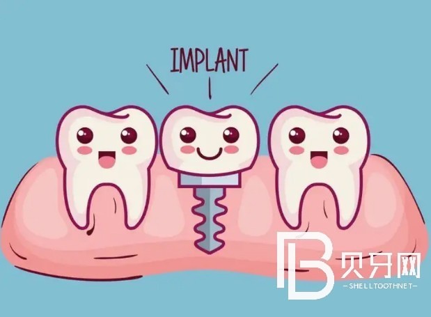 廣州柏德口腔種植牙好不好？收費(fèi)貴不貴？