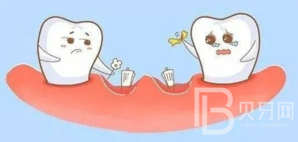 北京鈦植口腔上半口種植牙六顆好還是八顆好？