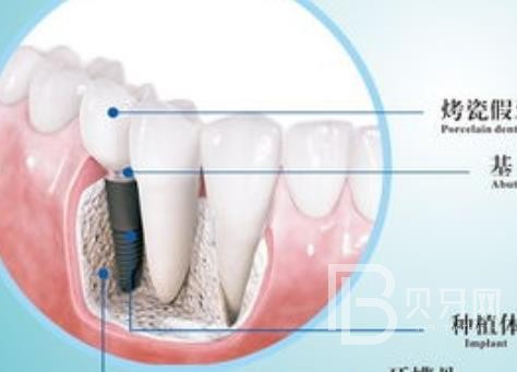 廣州優(yōu)德口腔正規(guī)靠譜嗎？廣州優(yōu)德口腔醫(yī)院位置在哪？