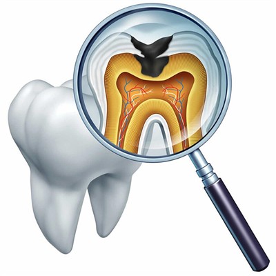 杭州一顆種植牙齒多少錢！杭州張永珍口腔診所種植牙價格表更新，瑞典尼奧斯neoss種植牙：8474元起/顆！