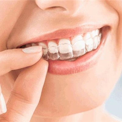 杭州一顆種植牙齒多少錢！杭州富陽昌華口腔診所種植牙價格一覽表，德國Camlog種植體：6917元起/顆！