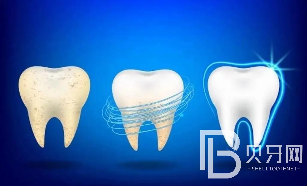 北京維爾口腔怎么樣？醫(yī)生實(shí)力如何？