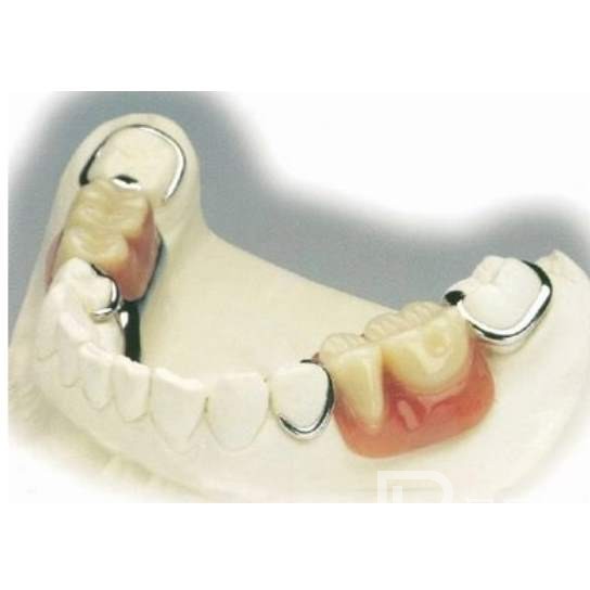 杭州種植一顆牙需多少錢！杭州潔奧口腔門診部(蕭山區(qū))2023全新種牙價目表，瑞士iti：6964元起/顆！