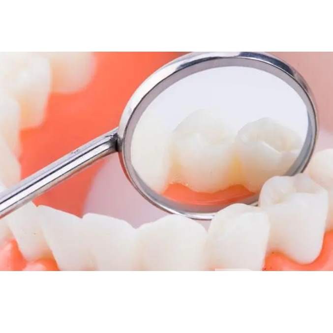 杭州種植牙一顆要多少錢！杭州錢塘門診部2023種牙價格表同步更新，國產(chǎn)百康特種植牙：4728元起/顆！