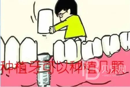 allon6種植牙是什么意思？東莞拜爾口腔