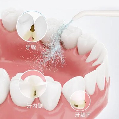 湖州牙貼美白整牙醫(yī)院排名前十預(yù)測(cè)！湖州富民門診部市民甄選~