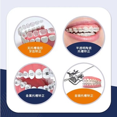 衢州冷光美白整牙醫(yī)院排名前十預(yù)測(cè)！衢州王江濱口腔收費(fèi)都不貴的