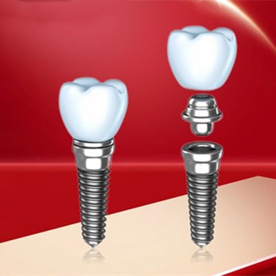 珠海種植牙價位！珠海輕松口腔門診部種植牙價目表已更新，韓國登騰種植體：2366元起/顆！